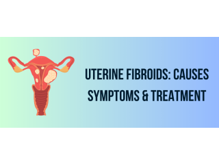 Uterine Fibroids: Causes, Symptoms & Treatment